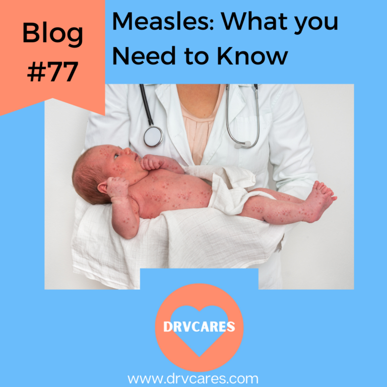 measles what you need to know