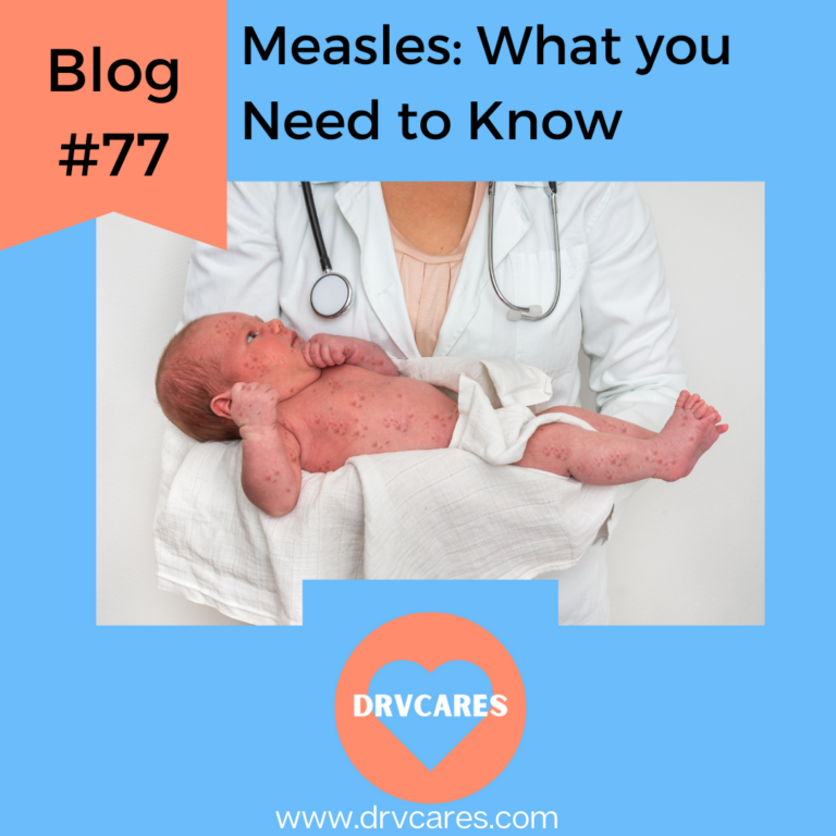 #77: Measles: What you Need to Know